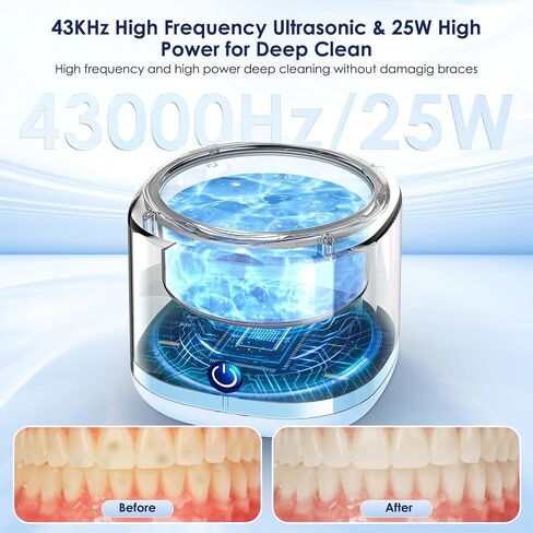 Wuven Ultrasonic Cleaner for Dentures, Invisalign, Mouth Guard, Aligner, Whitening Trays, 43kHz 180ML Portable Ultrasonic Jewelry Cleaner Ultrasonic Retainer Cleaner for Home and Travel Use Blue in Saudi Arabia