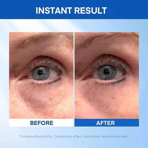 Eye Cream Anti Aging, Eye Cream for Dark Circles And Puffiness, Dark Circles Under Eye Treatment for Women, Under Eye Bags, Under Eye Cream, Eye Serum, Instant Eye Lift In 2 Mins, Made in USA in Saudi Arabia