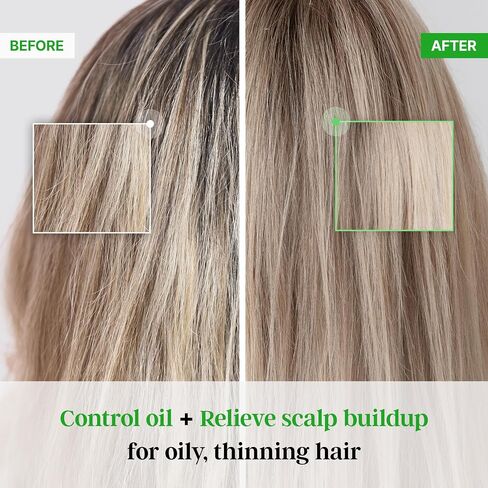 All New Plus TS Shampoo with Biotin for Anti-hair loss Care (16.9 Fl Oz) | Therapy Shampoo for Hair Loss Prevention | Korea Shampoo | Treat Hair Care for Damaged Hair for Men & Women in Saudi Arabia