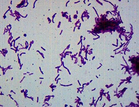 25pk Bacillus Smear, Gram Negative Stain - Prepared Microscope Slides - 75 x 25mm - Classroom Pack, 25 Slides in Storage Case - Biology & Microscopy - Eisco Labs in Saudi Arabia