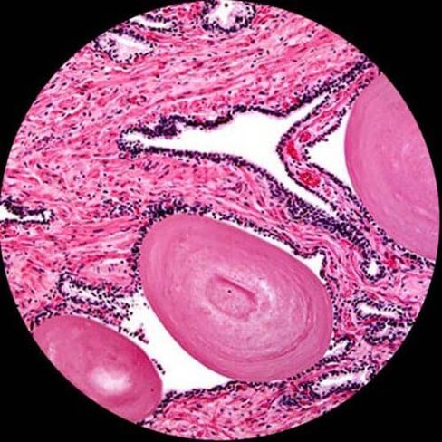 AmScope B120B Siedentopf Binocular Compound Microscope, 40X-2000X Magnification, Brightfield, LED Illumination, Abbe Condenser, Double-Layer Mechanical Stage in Saudi Arabia