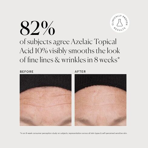Naturium Azelaic حمض موضعي 10%، علاج تجميلي للعناية بالوجه والبشرة مع النياسيناميد وفيتامين C، 1 أونصة in Kuwait