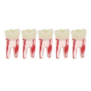 5Pcs Dental Root Canal Pulp Cavity Teeth Model Endodontic Practice RCT Typodont M8007 11# 14# 16# 21# 33# 34# 35# 36# 44# 45# Practicing Study Teach (5Pcs-M8007-36#)