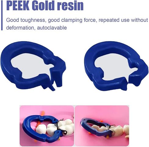 Windplusya Dental Sectional Matrix System kit, Dental Sectional Matrix Ring Resin Clip Clamping Ring, Autoclavable Dental Matrices Bands.(F4) in Saudi Arabia