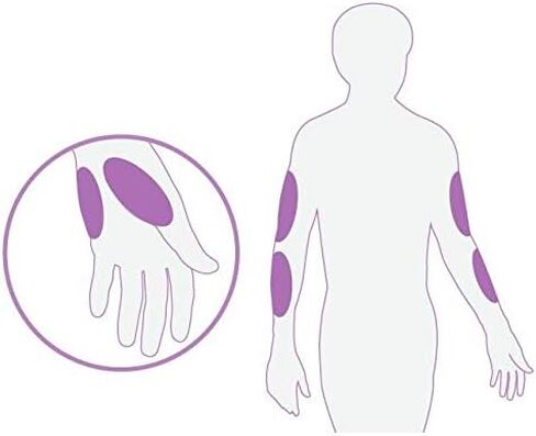 One Step Lancing Device Pen, 5 Depth Settings + AST Cap, Less Pain, Blood Sampling Pen, Accurate Blood Sample, Suitable for Twist Top Lancets, Blood Sugar Level Alternative Site Testing in Kuwait