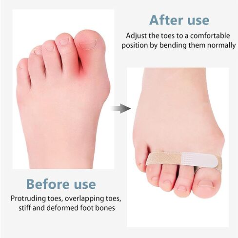 Finger Straps Buddy Tape 10 Pack, No Slip Buddy Finger Splints for Broken Toe, Hook and Loop Padded Washable and Reusable Finger Wrap for Broken/Sprained/Fractured/Injured Finger Support in Saudi Arabia