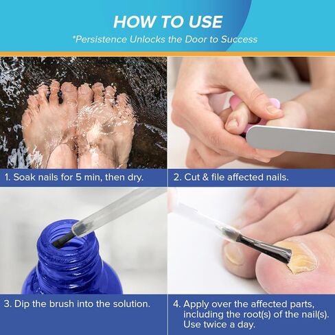 Toenail Fungus Treatment Extra Strength - Nail Fungus Treatment for Toenail - Toe Nail Fungus Treatment - Toenail Fungus Treatment - Nail Repair Solution for Fungal Fingernails & Toenails, 1 Fl Oz in Saudi Arabia