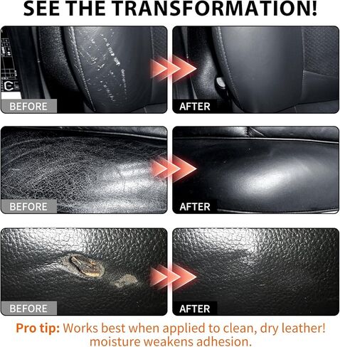 Leather Repair Kit,Car Seats, Sofa,Jacket & Purse - Repairs Burn Holes,Scratches,Tears - Restores Faux,Vinyl,Artificial and Real Leather (Black) in Kuwait