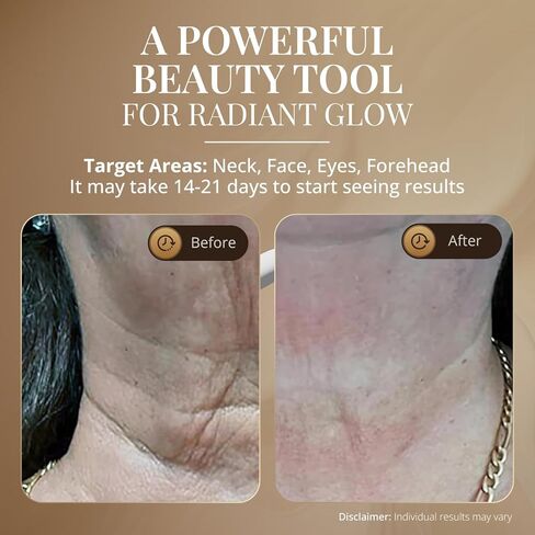 GLO24K Red Light Skin Rejuvenation Beauty Device for Face and Neck. Based on Triple Action LED, Thermal, and Vibration Technologies. Lifts and Tightens Sagging Skin for a Radiant Appearance. in Kuwait