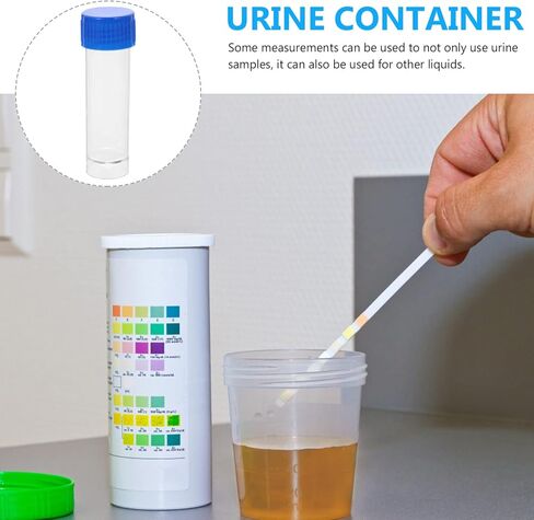 10PCS Specimen Cups 25-30ml Clear Cup with Screw On Lids – for Safe Pee, Stool, Sample for Testing in Saudi Arabia