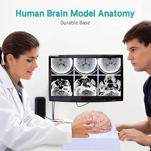 LVCHEN Human Brain Model Anatomy - Life Size Anatomical Brain Model with Arteries Detachable 8 Parts for Science Classroom Medical Neuroscience Teaching Study & Display Base in Saudi Arabia