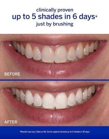 Supersmile The Works Whitening Toothpaste + Whitening Activator, Sassy Mint in Saudi Arabia