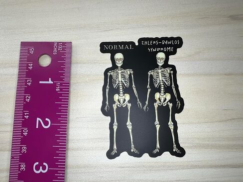 Ehlers-Danlos Syndrome Sticker, EDS Sticker, EDS Skeleton Humor, Ehlers Danlos Awareness, EDS Gift, Disability Awareness in Saudi Arabia