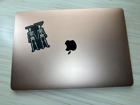 Ehlers-Danlos Syndrome Sticker, EDS Sticker, EDS Skeleton Humor, Ehlers Danlos Awareness, EDS Gift, Disability Awareness in Saudi Arabia