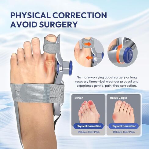 مصحح الورم للنساء والرجال عند إصبع القدم الكبير، جبيرة ورم قابلة للتعديل لتخفيف الورم، أداة فرد العظام لأصابع القدم مع حزام كعب مضاد للانزلاق ووسادة من السيليكون، مناسبة للقدم اليسرى واليمنى (1، رمادي) in Kuwait