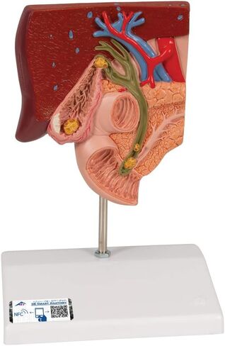 3B Scientific K26 Gallstone Model - 3B Smart Anatomy in Saudi Arabia