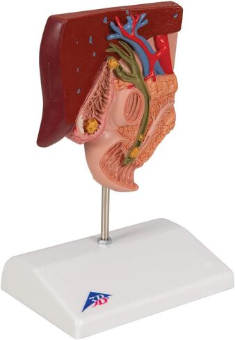 3B Scientific K26 Gallstone Model - 3B Smart Anatomy in Saudi Arabia