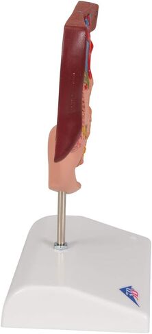 3B Scientific K26 Gallstone Model - 3B Smart Anatomy in Saudi Arabia