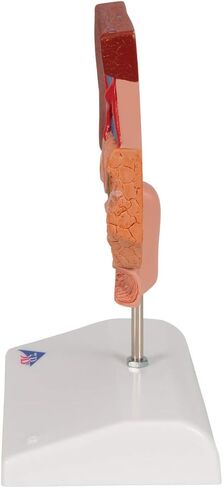 3B Scientific K26 Gallstone Model - 3B Smart Anatomy in Saudi Arabia