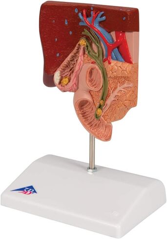 3B Scientific K26 Gallstone Model - 3B Smart Anatomy in Saudi Arabia