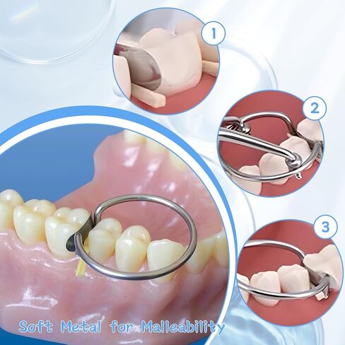 100 Pieces Stainless Steel Sectional Contoured Metal Dental Matrices Kit with Ledges, 0.035mm Thickness, Assorted Sizes Soft Metal Bands for Molar and Premolar Restorations - Dental Matrix System Kit in Saudi Arabia