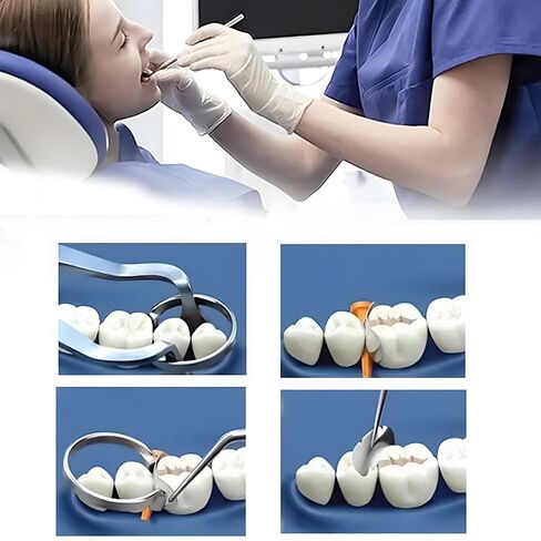 100 Pieces Stainless Steel Sectional Contoured Metal Dental Matrices Kit with Ledges, 0.035mm Thickness, Assorted Sizes Soft Metal Bands for Molar and Premolar Restorations - Dental Matrix System Kit in Saudi Arabia