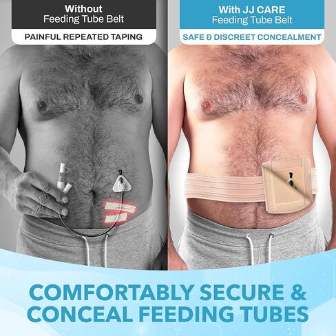 JJ CARE Feeding Tube Belt (Large/Extra Large), Breathable PEG Tube Belt, Nylon Fabric Gtube Belt Compatible with PEG Tubes and Gastrostomy Tubes, Adjustable and Washable G Tube Holder in Saudi Arabia