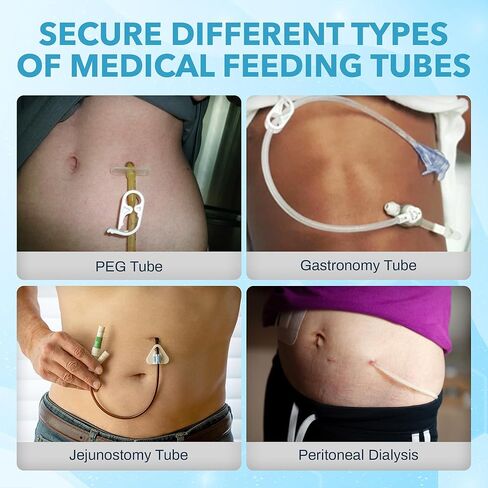 JJ CARE Feeding Tube Belt (Large/Extra Large), Breathable PEG Tube Belt, Nylon Fabric Gtube Belt Compatible with PEG Tubes and Gastrostomy Tubes, Adjustable and Washable G Tube Holder in Saudi Arabia