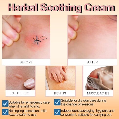 قطعتان من كريم مهدئ عشبي طبيعي بالكامل، مستخلصات نباتية طبيعية كريما عشبية مهدئة للصدفية، لتخفيف جفاف البشرة وشدها in Kuwait