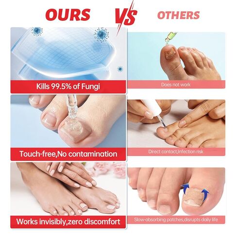 علاج فطريات الأظافر بقوة إضافية - 25% حمض غير ديسيلينيك، تركيبة نباتية لطيفة لأظافر الأصابع، يعالج تحت الأظافر وحولها، يعالج تغير اللون، ويصلح الأظافر السميكة والتالفة، 1.01 أونصة سائلة in Kuwait