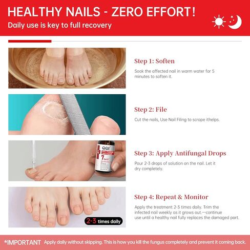 علاج فطريات الأظافر بقوة إضافية - 25% حمض غير ديسيلينيك، تركيبة نباتية لطيفة لأظافر الأصابع، يعالج تحت الأظافر وحولها، يعالج تغير اللون، ويصلح الأظافر السميكة والتالفة، 1.01 أونصة سائلة in Kuwait