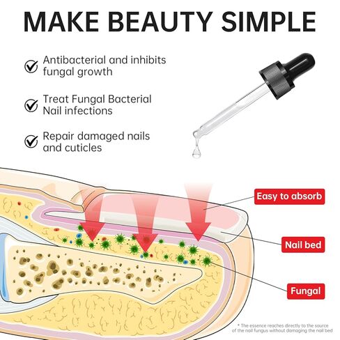 علاج فطريات الأظافر بقوة إضافية - 25% حمض غير ديسيلينيك، تركيبة نباتية لطيفة لأظافر الأصابع، يعالج تحت الأظافر وحولها، يعالج تغير اللون، ويصلح الأظافر السميكة والتالفة، 1.01 أونصة سائلة in Kuwait
