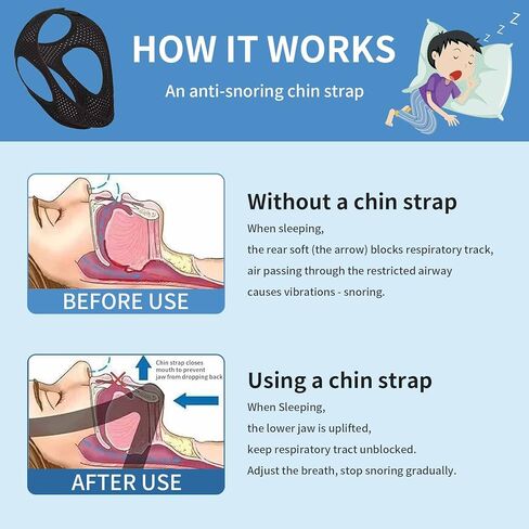 Anti-Snoring Chin Strap - Breathable Chin Straps for Snoring Users, Anti Snoring Nose Clip & Adjustable Sleep Chin Strap for Men/Women in Kuwait