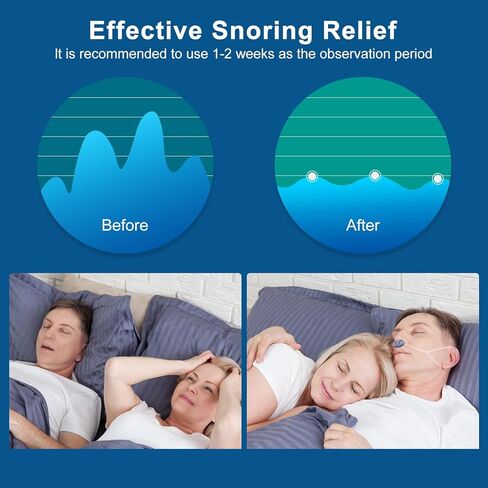 أجهزة مكافحة الشخير، حل الشخير للرجال والنساء، سدادة الشخير بحزام ثابت لنوم أفضل، سرعة الرياح قابلة للتعديل، دوامة مزدوجة، مناسبة لجميع أشكال الأنف، أزرق in Kuwait