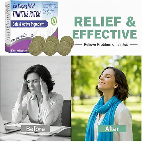 تخفيف طنين الأذن لرنين الأذن، رقعة تخفيف طنين الأذن تقلل بشكل فعال من رنين الأذن، والضوضاء الطنين وعدم الراحة في الأذن، 50 قطعة من رقع علاج طنين الأذن بتركيبة خفيفة، محمولة للنساء والرجال in Kuwait