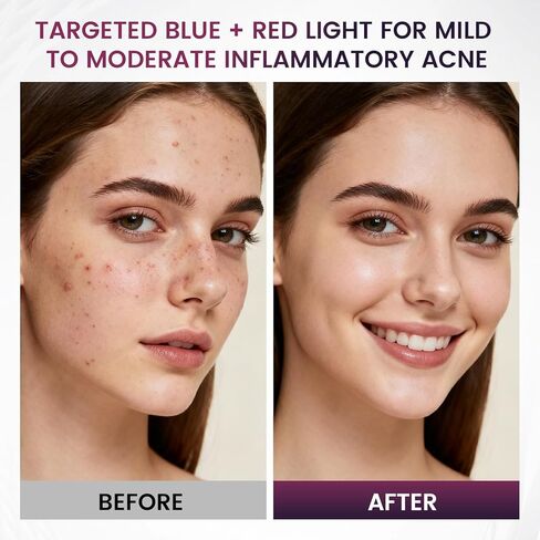 Red Light Therapy for Face, 850nm Infrared LED Face Mask Light Therapy with 280 LEDs, Cordless Red Light Therapy Device with 5 & 10 Min Timer, FDA Cleared Light Therapy Mask in Saudi Arabia