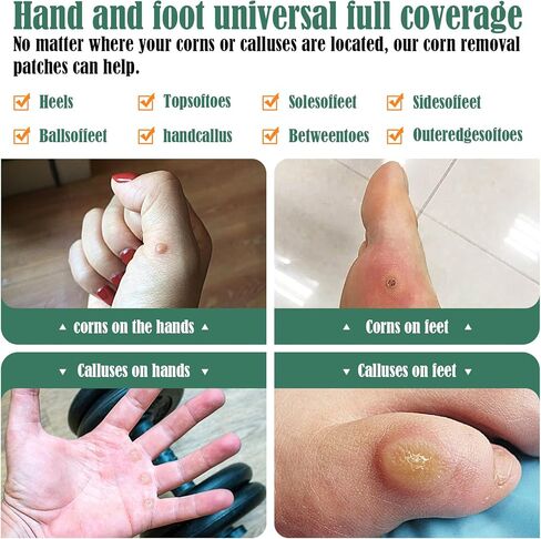 ضمادات طبية سريعة الفعالية للبالغين، وسادات مزيلة للذرة مع 40% حمض الساليسيليك - 36 قطعة، علاج سريع وفعال للقدمين وأصابع القدم in Kuwait