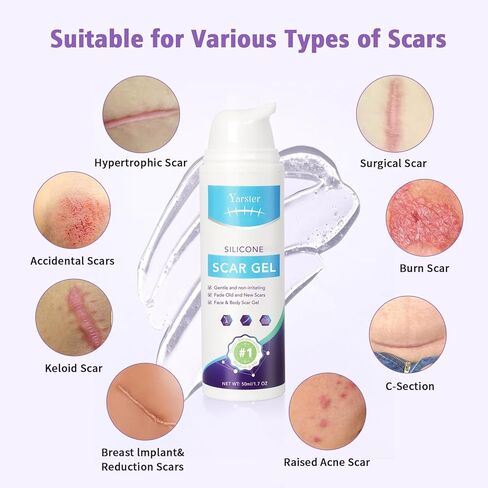 Silicone Scar Gel Scar Cream, Treats Old and New Scars, Stretch Marks Removal Formula Helps from Surgical, Burns, Acne Scar Treatment with Advanced Scar Gel, 1.7 oz (50ml) in Saudi Arabia