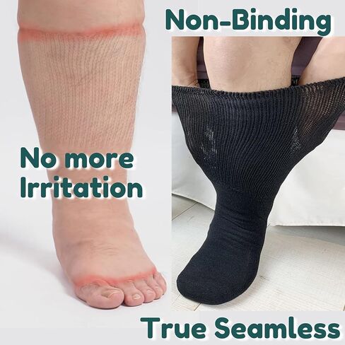 جوارب Gooi واسعة جدًا لمرضى السكري للأقدام المتورمة، جوارب ملونة لمرضى السكري للنساء مقاس كبير 13-15 10-13 9-13، تدفئة الساق واسعة، حرارية، كبيرة وطويلة، ناعمة قابلة للتمدد، وذمة السمنة، الاعتلال العصبي in Kuwait