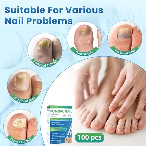 Fungal Nail Treatment Swabs–100 Ct, Extra Strength Toenail & Athlete’s Foot Fungus Treatment with 25% Undecylenic Acid, Damaged, Discolored & Thick Nails, Restores Healthy Nail Growth in Saudi Arabia
