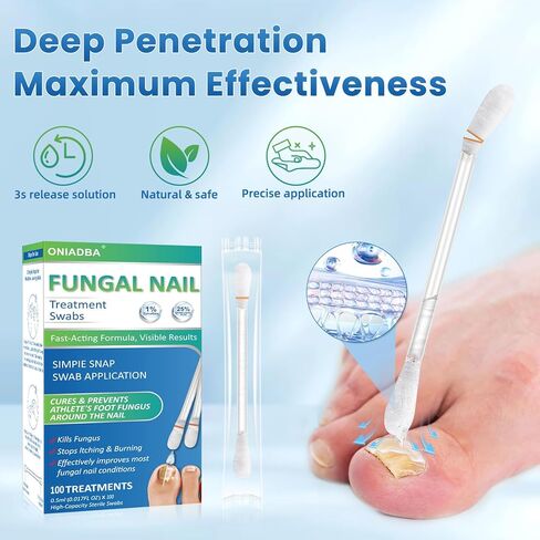 Fungal Nail Treatment Swabs–100 Ct, Extra Strength Toenail & Athlete’s Foot Fungus Treatment with 25% Undecylenic Acid, Damaged, Discolored & Thick Nails, Restores Healthy Nail Growth in Saudi Arabia