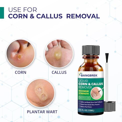مزيلات الذرة لأصابع القدم: إزالة الذرة بحمض الساليسيليك السائل للقدمين - مزيل مسامير القدم للقدمين بقوة إضافية (1 مل) in Kuwait