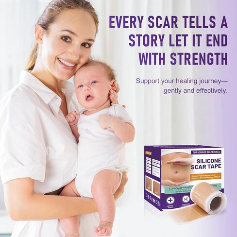 شريط الندبات للندبات الجراحية - أوراق الندبات المصنوعة من السيليكون الطبي وشريط الندبات لإزالة الجدرة، واستعادة القسم C، وشد البطن، وعلامات الحروق أو الإصابة، وشرائط السيليكون الناعمة القابلة لإعادة الاستخدام (1.6 بوصة × 60 بوصة) in Kuwait