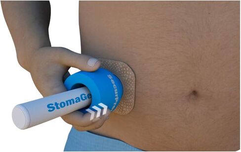 جهاز Stoma Secure - عبوة واحدة - (1 1/2 بوصة)، لأي نوع من فغر اللفائفي، وفغر البول، وحقيبة فغر القولون/تغيير لوحة القاعدة، وحماية الجلد، ومنع التسرب. in Kuwait