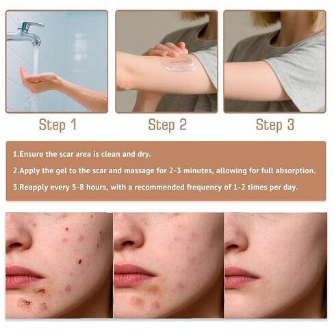 60% Silicone Scar Stick, Skin Scar Solutions for Face and Body, Stick Applicator Manual Massage, with Centella Asiatica Extracts and Vitamin E, Soothing & Gentle for All Skin Scar Types in Saudi Arabia