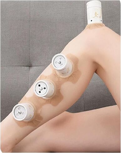 Moxibustion jar,Moxibustion Box, Moxibustion Tube, Moxibustion Tools, Moxibustion Set艾灸盒艾灸罐, Small Volume, Simple Operation, Easy Storage in Saudi Arabia