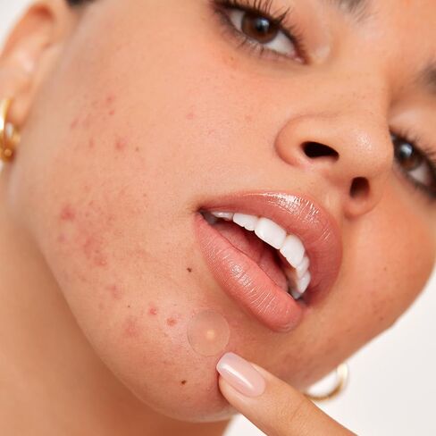 PEACE OUT Acne Healing Dots Helps Clear Blemishes Overnight, Fast Acting Hydrocolloid Pimple Patches for Breakouts with Salicylic Acid, Retinol and Aloe Vera, Award Winning Skincare Solution 40 Count in Saudi Arabia