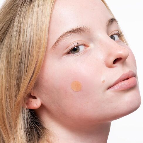 PEACE OUT Acne Healing Dots Helps Clear Blemishes Overnight, Fast Acting Hydrocolloid Pimple Patches for Breakouts with Salicylic Acid, Retinol and Aloe Vera, Award Winning Skincare Solution 40 Count in Saudi Arabia