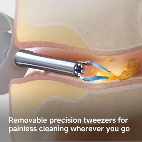 كاميرا أداة إزالة شمع الأذن، منظف الأذن المقاوم للماء IP67 مع الكاميرا، مزيل شمع الأذن البصري، مجموعة تنظيف الأذن للبالغين والأطفال من العائلة in Kuwait