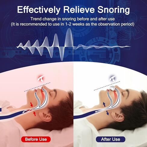 Anti Snoring Devices, Adjustable Wind Speed Snoring Solution, Electric Anti Snoring Devices Nasal Dilator Nose Vents Plugs,Stop Snoring Suitable for Men & Women(White) in Saudi Arabia